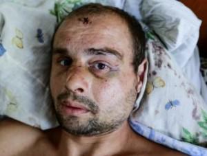 Селянин обвинил лидера Самообороны Запорожья в жестоком избиении