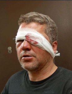 Экс-бойца избили во время пьяной драки в кафе, — полиция